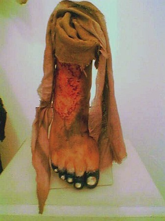 Pestis